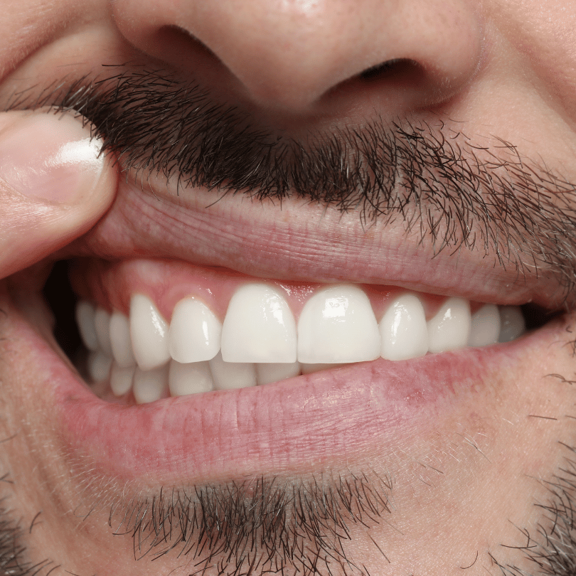 endodoncja częstochowa